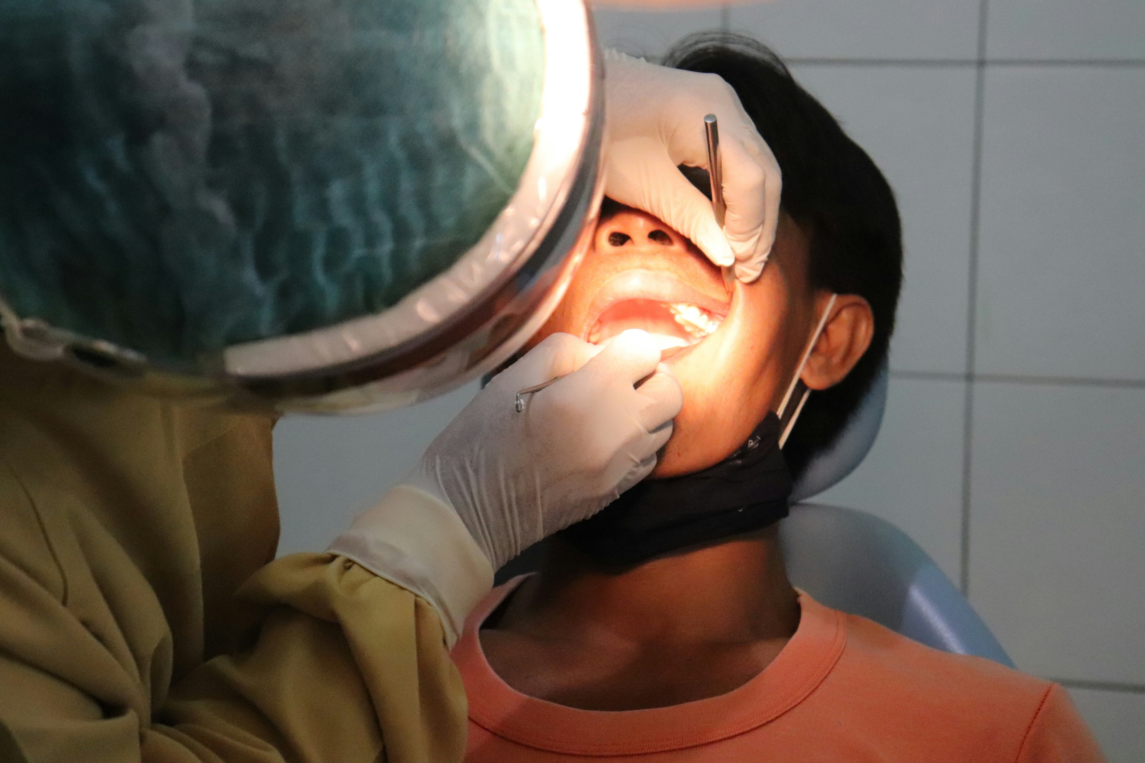 All-on-4 Implants